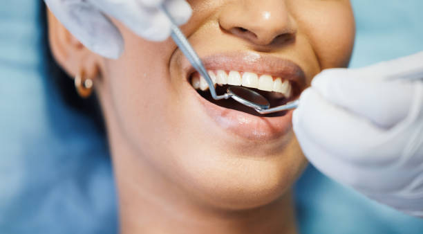 Best Emergency Tooth Extraction in Mentone, IN