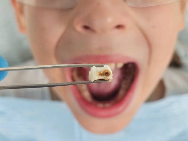 Best Weekend Emergency Dentist in Mentone, IN